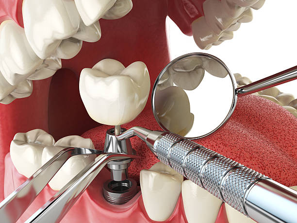 Best 24-Hour Emergency Dentist in Mount Repose, OH